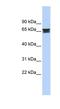 Zinc Finger Protein 614 antibody, NBP1-80370, Novus Biologicals, Western Blot image 