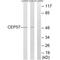 Centrosomal Protein 57 antibody, A07898, Boster Biological Technology, Western Blot image 