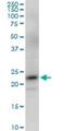 Progesterone Receptor Membrane Component 2 antibody, H00010424-M03, Novus Biologicals, Western Blot image 
