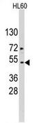 Actin Alpha Cardiac Muscle 1 antibody, AP11506PU-N, Origene, Western Blot image 