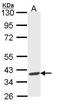 Aryl Hydrocarbon Receptor Interacting Protein antibody, GTX113891, GeneTex, Western Blot image 