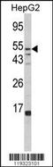 Alpha-L-Fucosidase 1 antibody, MBS9204117, MyBioSource, Western Blot image 