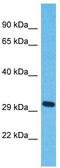 Olfactory Receptor Family 5 Subfamily J Member 2 antibody, TA337529, Origene, Western Blot image 