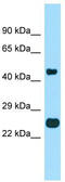 Transmembrane BAX Inhibitor Motif Containing 4 antibody, TA333785, Origene, Western Blot image 