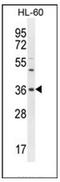 Olfactory Receptor Family 1 Subfamily J Member 4 antibody, AP53023PU-N, Origene, Western Blot image 