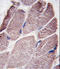 Protein Tyrosine Phosphatase Non-Receptor Type 21 antibody, LS-C101000, Lifespan Biosciences, Immunohistochemistry paraffin image 