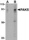 Serine/threonine-protein kinase PAK 7 antibody, TA306115, Origene, Western Blot image 
