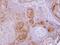 Gamma-Butyrobetaine Hydroxylase 1 antibody, GTX103127, GeneTex, Immunohistochemistry paraffin image 