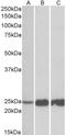 Troponin I2, Fast Skeletal Type antibody, LS-C186614, Lifespan Biosciences, Western Blot image 
