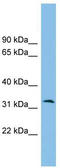 Zona Pellucida Binding Protein 2 antibody, TA337617, Origene, Western Blot image 