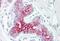 EPH Receptor B6 antibody, MBS244388, MyBioSource, Immunohistochemistry paraffin image 