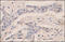 Asparagine Synthetase (Glutamine-Hydrolyzing) antibody, 252086, Abbiotec, Immunohistochemistry paraffin image 
