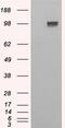 Ectonucleotide Pyrophosphatase/Phosphodiesterase 1 antibody, PA5-18429, Invitrogen Antibodies, Western Blot image 