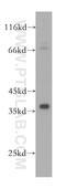 Kelch Like Family Member 14 antibody, 16693-1-AP, Proteintech Group, Western Blot image 