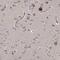 Kelch Domain Containing 3 antibody, NBP1-85198, Novus Biologicals, Immunohistochemistry paraffin image 