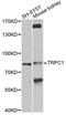 Transient Receptor Potential Cation Channel Subfamily C Member 1 antibody, STJ111993, St John