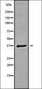 Formin Binding Protein 4 antibody, orb338317, Biorbyt, Western Blot image 