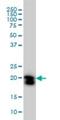 Ras Homolog Family Member A antibody, H00000387-M05, Novus Biologicals, Western Blot image 