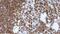 CD7 Molecule antibody, GTX01945, GeneTex, Immunohistochemistry paraffin image 