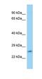 LRAT Domain Containing 1 antibody, orb325788, Biorbyt, Western Blot image 