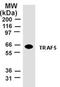 TNF Receptor Associated Factor 5 antibody, TA336671, Origene, Western Blot image 