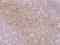 SAM Domain, SH3 Domain And Nuclear Localization Signals 1 antibody, 200383-T08, Sino Biological, Immunohistochemistry paraffin image 