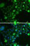 Ubiquitin Conjugating Enzyme E2 Z antibody, 22-796, ProSci, Immunofluorescence image 