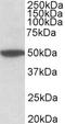 Cholinergic Receptor Muscarinic 2 antibody, LS-C155048, Lifespan Biosciences, Western Blot image 