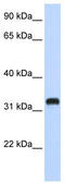 Chromosome 21 Open Reading Frame 62 antibody, TA338940, Origene, Western Blot image 