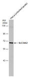 Solute Carrier Family 34 Member 2 antibody, GTX131043, GeneTex, Western Blot image 