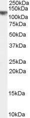 CYLD Lysine 63 Deubiquitinase antibody, GTX89126, GeneTex, Western Blot image 