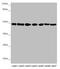 Ubiquinol-Cytochrome C Reductase Core Protein 2 antibody, LS-C676691, Lifespan Biosciences, Western Blot image 