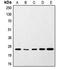 Synaptosome Associated Protein 25 antibody, orb214594, Biorbyt, Western Blot image 