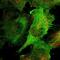 Cyclase Associated Actin Cytoskeleton Regulatory Protein 2 antibody, NBP2-30572, Novus Biologicals, Immunocytochemistry image 