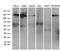 Receptor Tyrosine Kinase Like Orphan Receptor 2 antibody, M01840, Boster Biological Technology, Western Blot image 