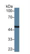 Carboxypeptidase N Subunit 1 antibody, abx101845, Abbexa, Western Blot image 