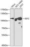 Eukaryotic Translation Elongation Factor 2 antibody, 18-477, ProSci, Western Blot image 