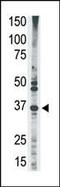 MAGE Family Member A2B antibody, PA5-13151, Invitrogen Antibodies, Western Blot image 