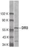 TNF Receptor Superfamily Member 25 antibody, PA5-19866, Invitrogen Antibodies, Western Blot image 