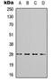 Tyrosine 3-Monooxygenase/Tryptophan 5-Monooxygenase Activation Protein Theta antibody, orb315829, Biorbyt, Western Blot image 