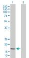 Protein Phosphatase 3 Regulatory Subunit B, Beta antibody, H00005535-D01P, Novus Biologicals, Western Blot image 