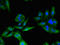 SLP-65 antibody, LS-C677300, Lifespan Biosciences, Immunofluorescence image 