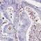 Taste 2 Receptor Member 38 antibody, HPA043862, Atlas Antibodies, Immunohistochemistry paraffin image 