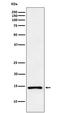 Natriuretic Peptide A antibody, M01318, Boster Biological Technology, Western Blot image 