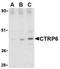 C1q And TNF Related 6 antibody, NBP1-76633, Novus Biologicals, Western Blot image 