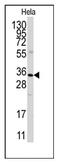 Annexin A3 antibody, AP12480PU-N, Origene, Western Blot image 