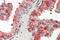 Acid Phosphatase, Prostate antibody, GTX88063, GeneTex, Immunohistochemistry paraffin image 