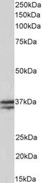 Threonine Synthase Like 2 antibody, 43-222, ProSci, Enzyme Linked Immunosorbent Assay image 