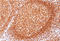 CD79a antibody, AM32862PU-T, Origene, Immunohistochemistry frozen image 