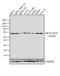 Serine/threonine-protein kinase akt-2 antibody, PA1-41144, Invitrogen Antibodies, Western Blot image 